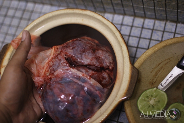 cara-cara-membasuh-placenta-uri-031