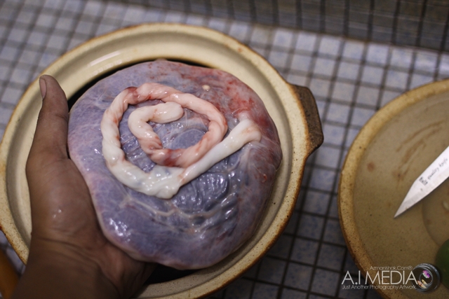 cara-cara-membasuh-placenta-uri-036